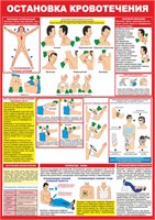 Стенд "Остановка кровотечения" формат А2 594 х 420мм, пластик 3мм